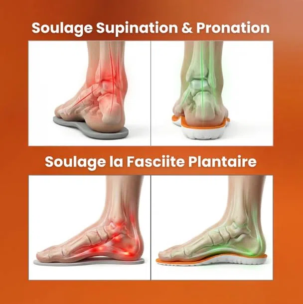 SWZEC Solvian Semelles anti-douleur plantaire